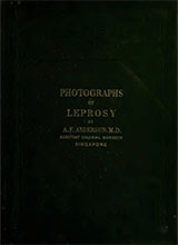 photographs-coloured-of-leprosy-as-met-with-in-the-straits-settlements-published-1872